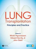 Lung Transplantation: Principles And Practice