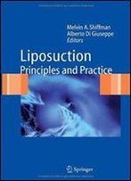 Liposuction: Principles And Practice