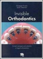 Invisible Orthodontics: Current Concepts And Solutions In Lingual Orthodontics