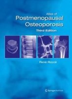 Atlas Of Postmenopausal Osteoporosis: Third Edition